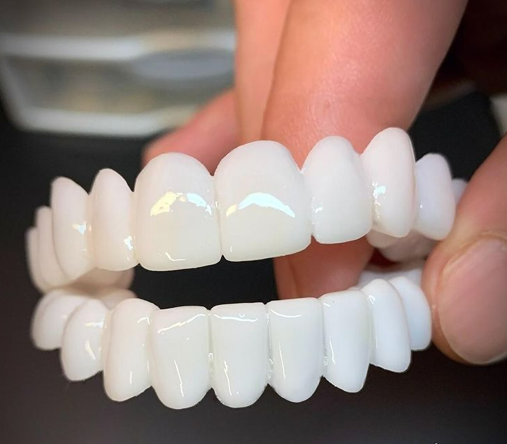 Dental Prosthesis – Comfort, Daily Use