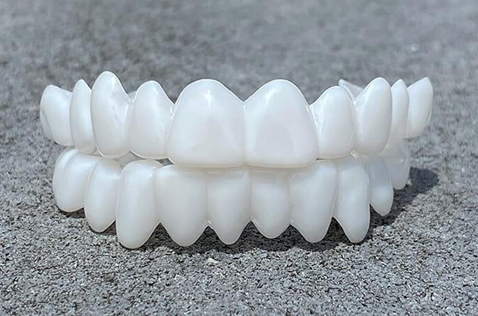 Dental Prosthesis – Comfort, Daily Use