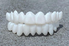 Dental Prosthesis – Comfort, Daily Use