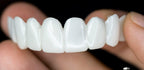 Dental Prosthesis – Comfort, Daily Use