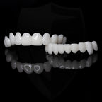 Dental Prosthesis – Comfort, Daily Use