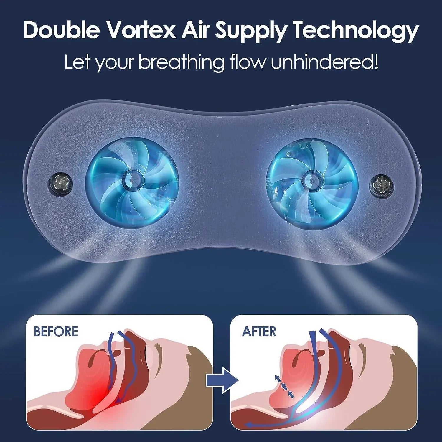 Micro CPAP Sleep Apnea Machine – Travel, Anti-Snoring