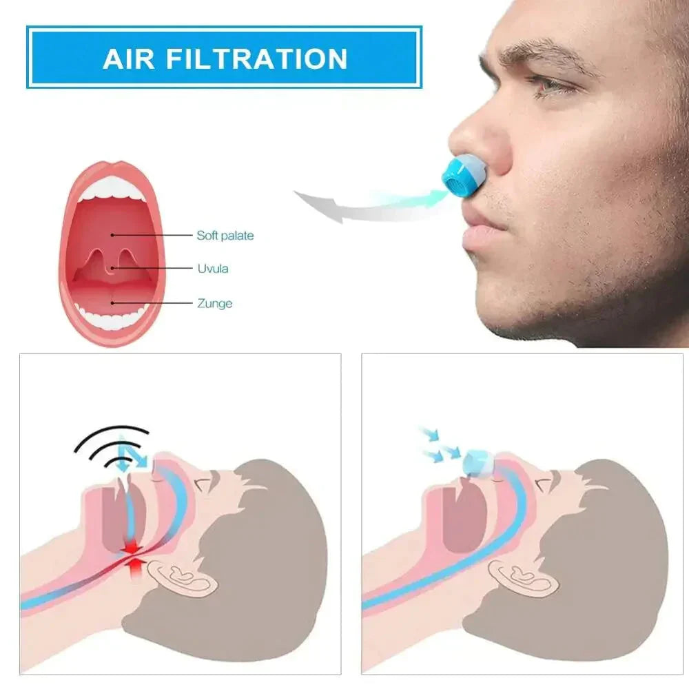 Micro CPAP Sleep Apnea Machine – Travel, Anti-Snoring